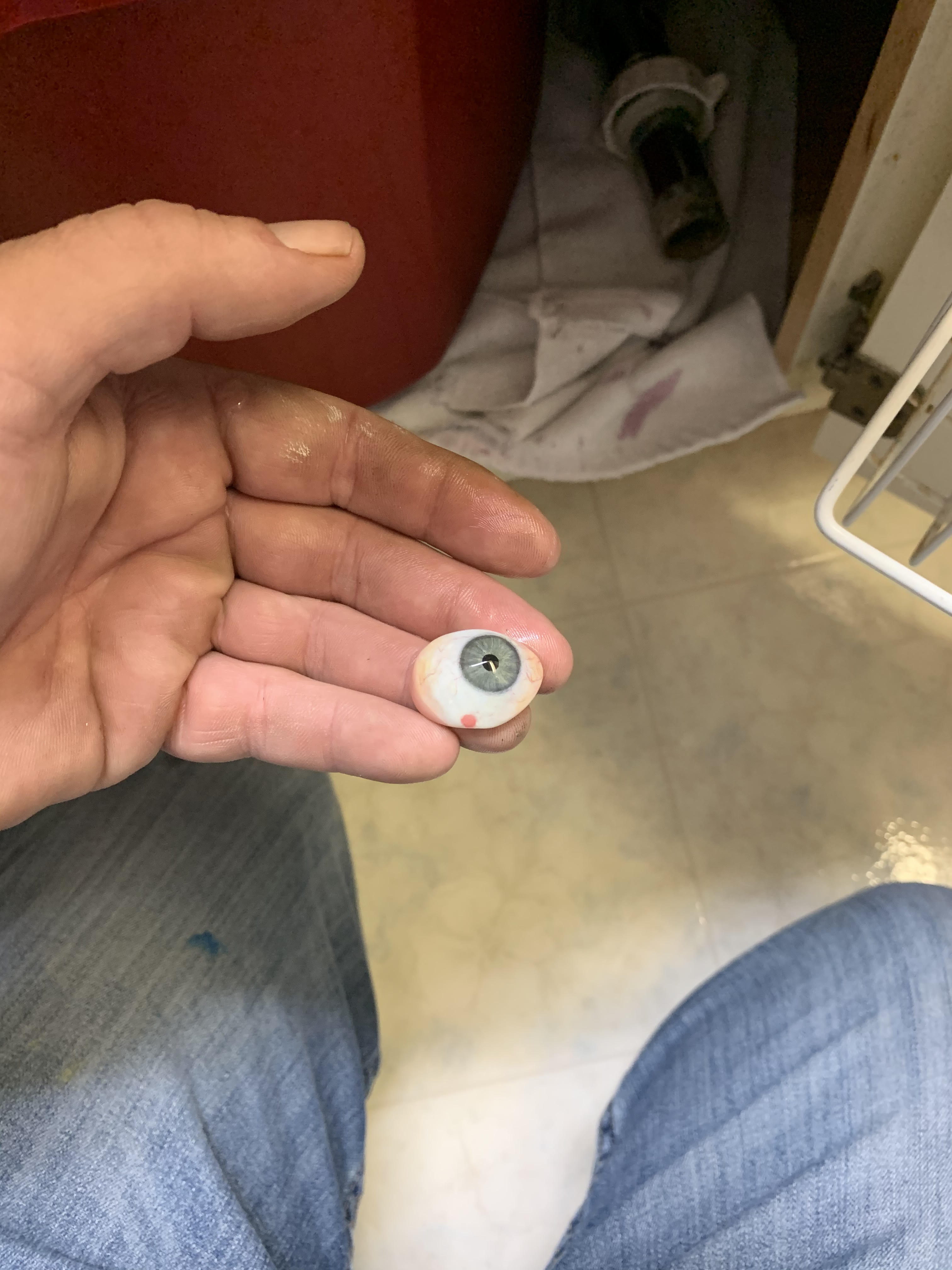 Prosthetic Eye